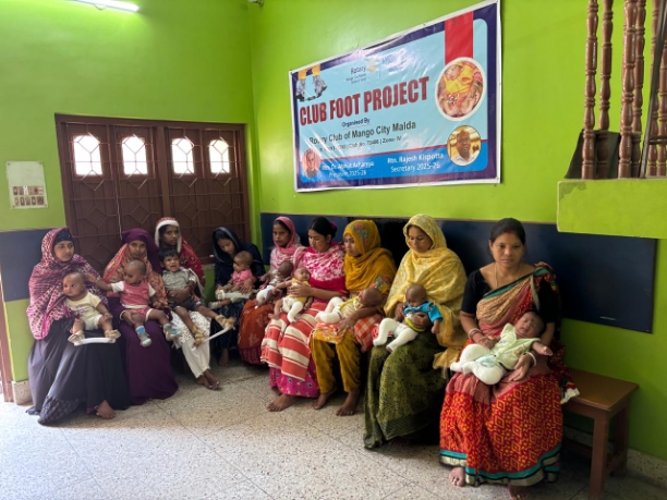 Clubfoot Follow up Clinic (Permanent Project)