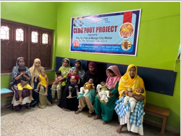 Club Foot Followup Clinic (Permanent Project)