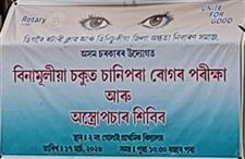 Cataract Detection and Follow up Operation Camp