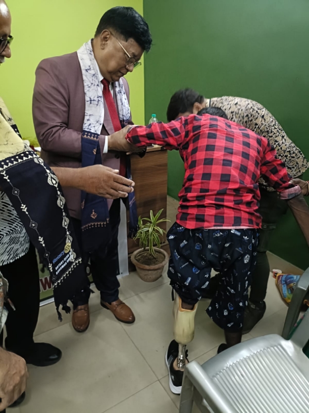 Artificial limb Distribution 
