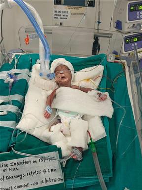 Peadatric Heart Surgery -Global Grant