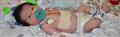 Global Grant - Spandan - Little Heart Surgery