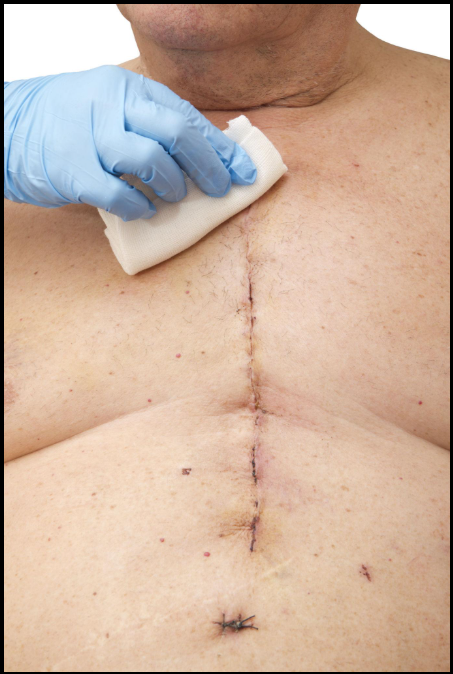 HEART MEDICAL TREATMENT