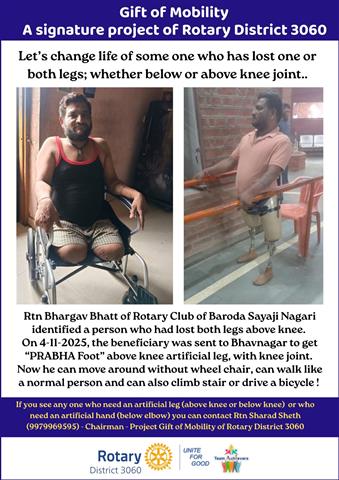 Artificial Leg
